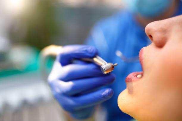 Best Teeth Whitening  in Steamboat Springs, CO